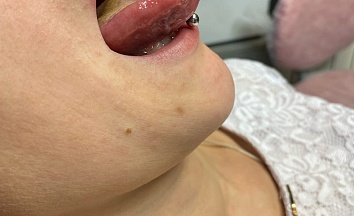 ������� � ������������